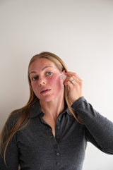 TruDermal Microneedling Infusion Kits